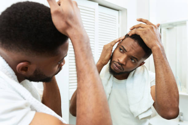 istock Young african man checking for thinning hair in mirror at bathroom 1184172608