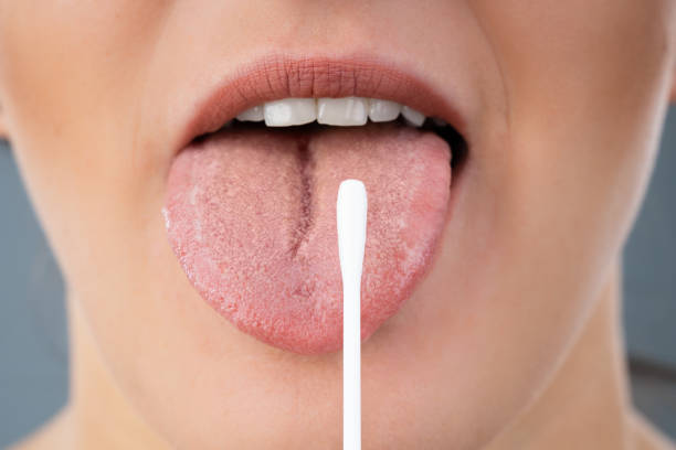 istock Taking Saliva Test From Woman's Mouth 1184215929