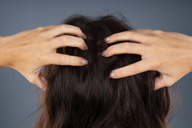 istock Woman Scratching Her Itchy Head 1184215968