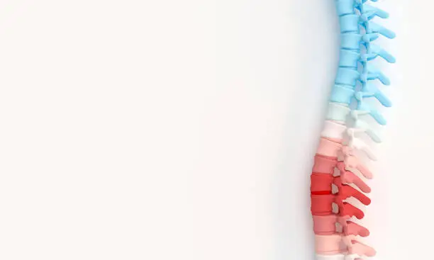 3d illustration render of a spine with highlighted aching parts. Back care concept.