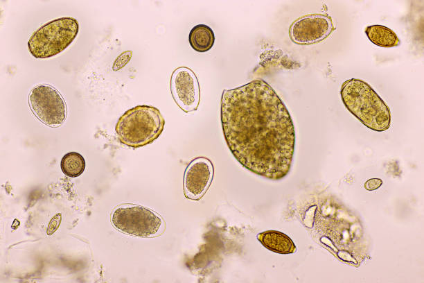 istock Mix of helminths or parasitic worm in human stool 1184437872