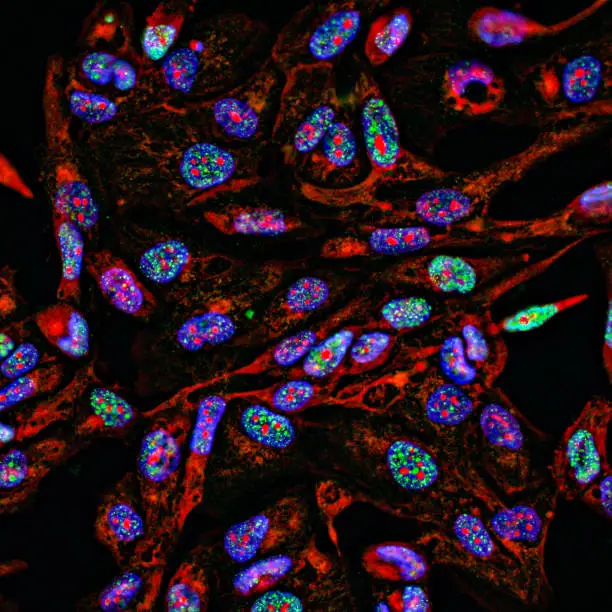 Photo of Fluorescent Imaging immunofluorescence of cancer cells growing in 2D with nuclei in blue, cytoplasm in red and DNA damage foci in green