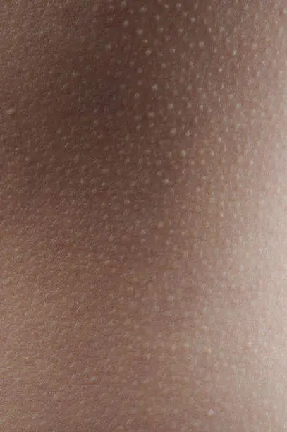 Brown skin texture with goose bumps flat view
