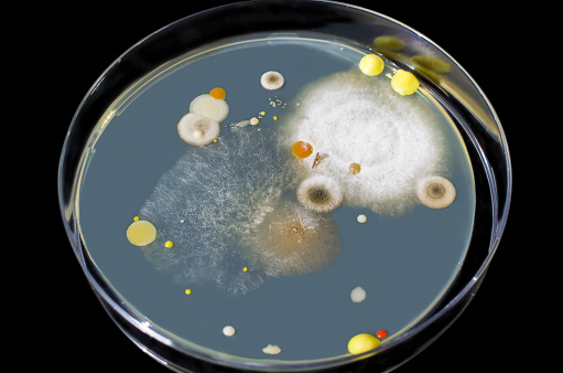 Colonies of bacteria and mold fungi cultivated from indoor air on Petri dish with nutrient medium