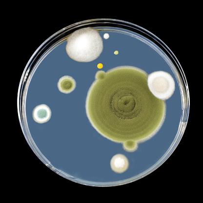 Colonies of mold fungi cultivated from indoor air on Petri dish with Sabourad dextrose agar, SDA