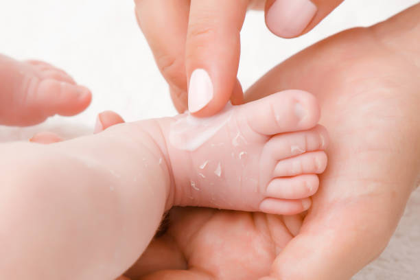 Ocean porcelæn slot 1,200+ Baby Dry Skin Stock Photos, Pictures & Royalty-Free Images - iStock  | Eczema, Baby cream, Baby lotion
