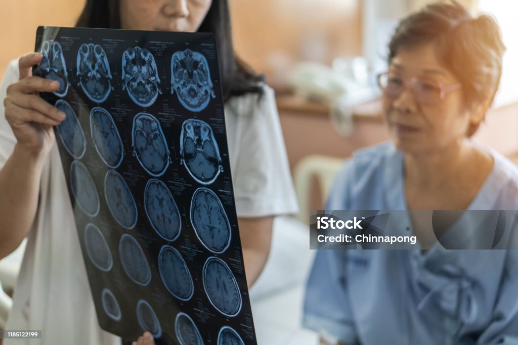 Brain disease diagnosis with medical doctor diagnosing elderly ageing patient neurodegenerative illness problem seeing Magnetic Resonance Imaging (MRI) film for neurological medical treatment Stroke - Illness Stock Photo Brain disease diagnosis with medical doctor diagnosing elderly ageing patient neurodegenerative illness problem seeing Magnetic Resonance Imaging (MRI) film for neurological medical treatment Stroke - Illness Stock Photo