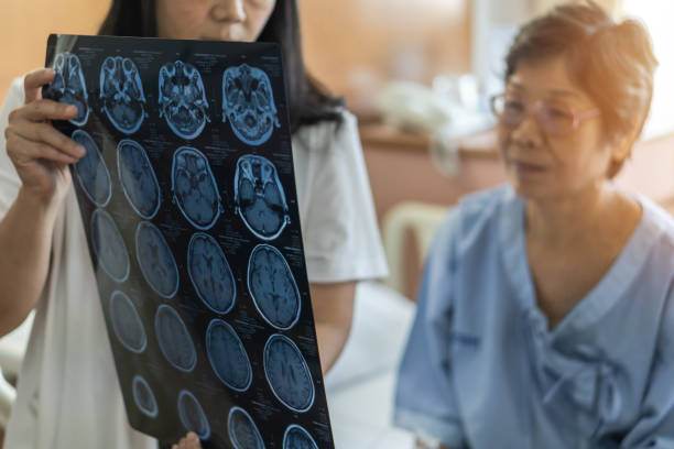 brain disease diagnosis with medical doctor diagnosing elderly ageing patient neurodegenerative illness problem seeing magnetic resonance imaging (mri) film for neurological medical treatment - caos imagens e fotografias de stock