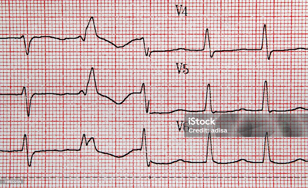 EKG - Photo de Choix libre de droits