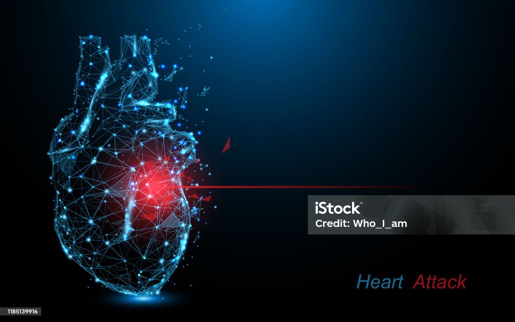Menschlicher Herzinfarkt. Herzkrankheiten bilden Linien, Dreiecke und Partikel-Stil-Design - Lizenzfrei Herz - Anatomiebegriff Vektorgrafik