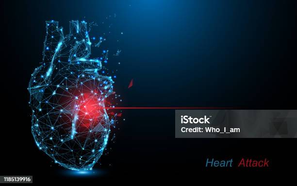 Menschlicher Herzinfarkt Herzkrankheiten Bilden Linien Dreiecke Und Partikelstildesign Stock Vektor Art und mehr Bilder von Herz - Anatomiebegriff