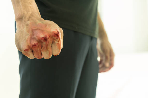 Aggressive violent man in a fight, with a blood fist. stock photo