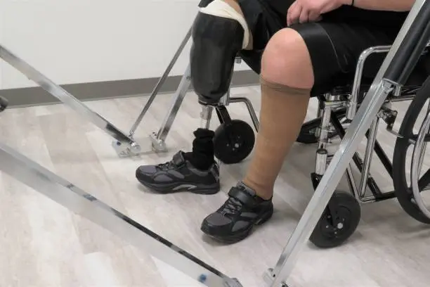 An amputee Veteran in a wheel chair tries on his new prosthetic (artificial) limb (leg) for the first time at the prosthetist's medical office.