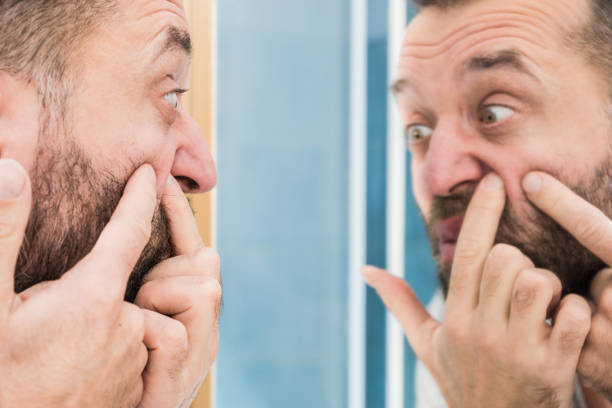 istock Man looking at pimples on his face 1185319748