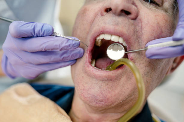 istock Senior man at the dentist 1185452500