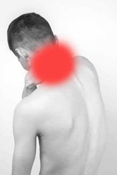 black and white shot of man from back having red spot of pain and trauma in neck. - inflammation back physical therapy isolated on white imagens e fotografias de stock