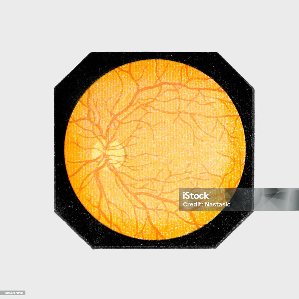Intact Eye Intact Eye Inside Stock Illustration - Download Image Now - Eye, Vein ...