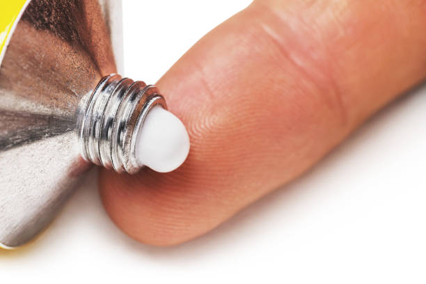 Cream squeezed from a tube onto a finger, close-up. Healing ointment