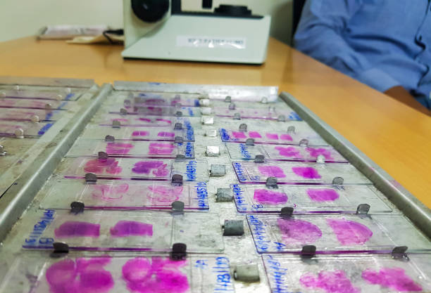 istock histopathology slides stained with leishman stain, displayed and ready for microscopy. 1185801205