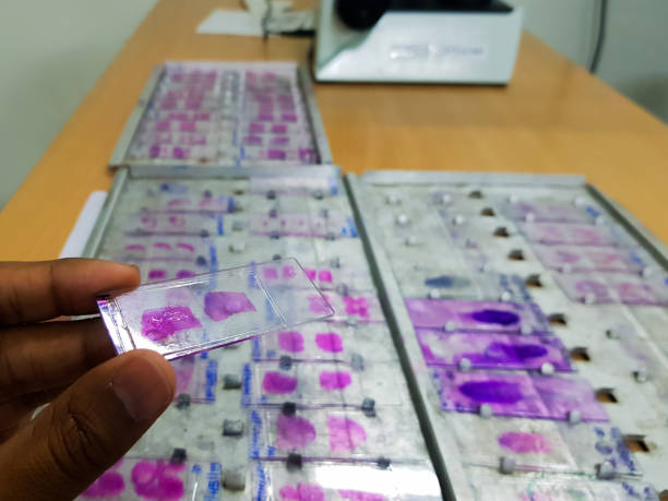 mano, sosteniendo diapositivas de histopatología manchadas con mancha de leishman, mostradas y listas para la microscopía. - tinción acidorresistente fotografías e imágenes de stock