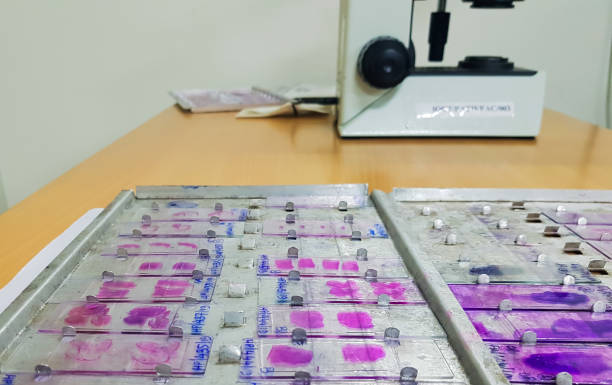 istock histopathology slides stained with leishman stain, displayed and ready for microscopy. 1185801246