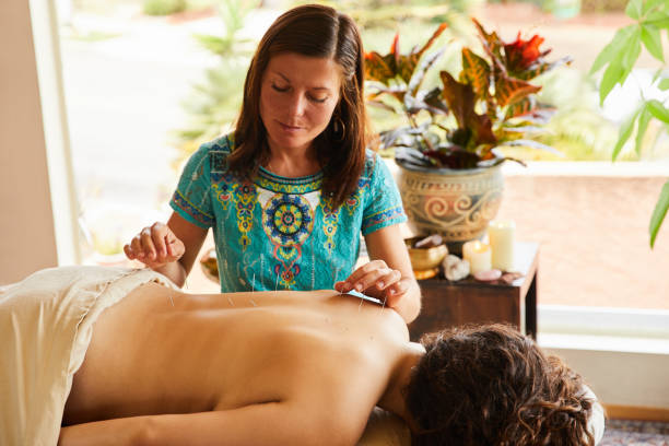 therapist doing acupuncture in her alternative medicine clinic - reiki alternative therapy massaging women imagens e fotografias de stock