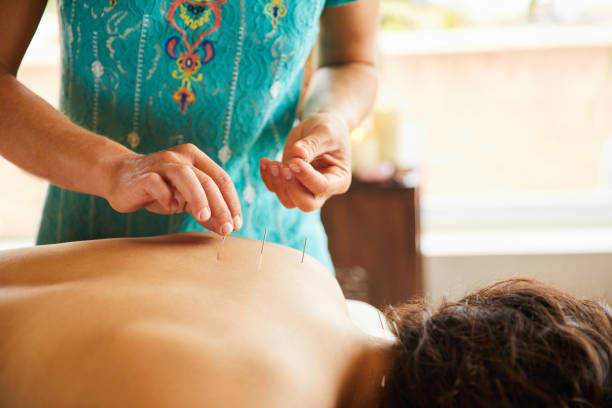 istock Acupuncturist performing a treatment on a female client 1185863271