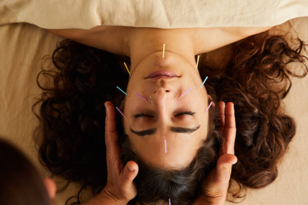 Woman having an acupuncture and reiki treatment on her face High angle of a woman lying on a table in an alternative medicine spa having an acupuncture and reiki treatment done on her face by an acupucturist acupuncture photos stock pictures, royalty-free photos & images