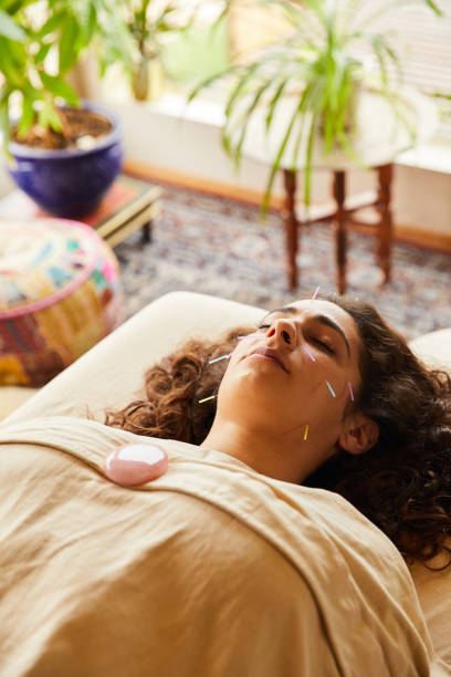 donna sdraiata sul tavolo con aghi agopuntura in faccia - massaging relaxation indoors traditional culture foto e immagini stock