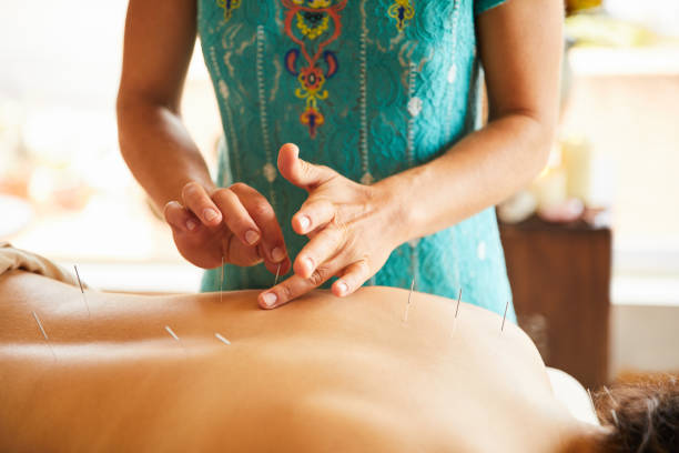 istock Acupuncturist treating a female client in her clinic 1185874080