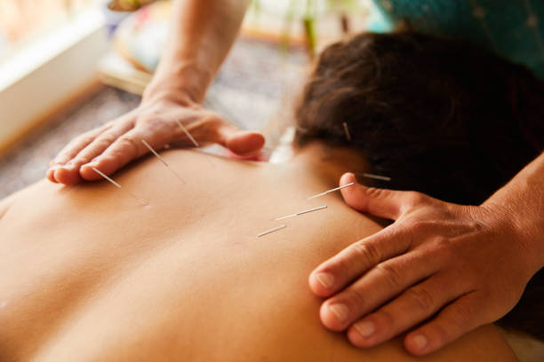 alternativer therapeut, der reiki und akupunktur auf dem rücken eines patienten durchführt - alternative medicine massaging spa treatment back stock-fotos und bilder