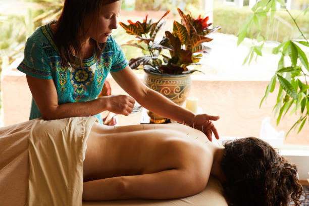 alternativer therapeut vorformiert akupunktur auf dem rücken eines patienten - alternative medicine massaging spa treatment back stock-fotos und bilder