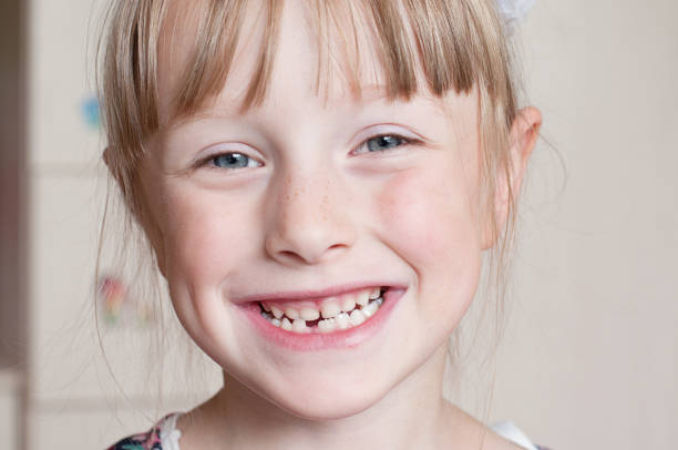 istock Five-year-old girl smiles without a tooth 1185915865