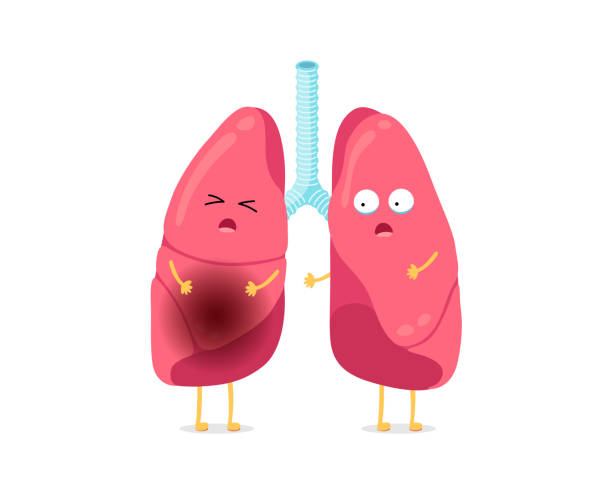Cute Cartoon Funny Unhealthy Illness Lungs Character Suffering Sick Lung  Mascot With Pneumonia Human Respiratory System Internal Organ Inflammation  Medical Anatomy Vector Illusrtation Stock Illustration - Download Image Now  - iStock
