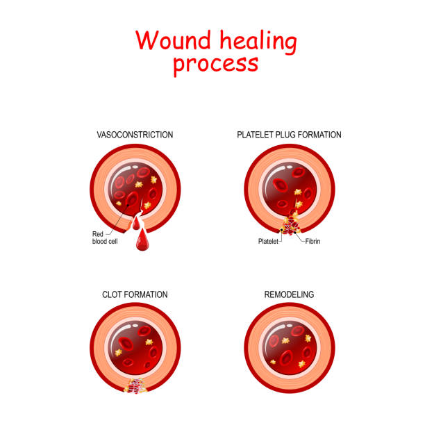 Wound Healing Diagram Biology Diagrams
