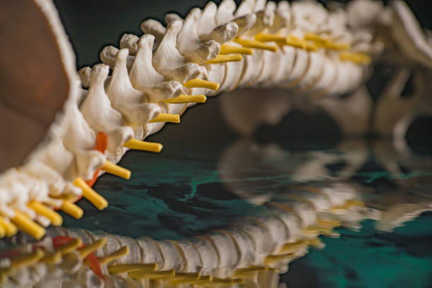 Model of vertebrae and discs. Evolution of neurodegenerative disease.