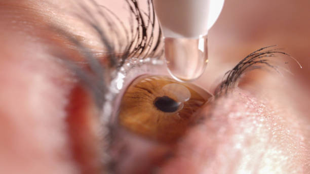 MACRO: Eye contracts and relaxes when droplet touches surface of eye MACRO: Shiny clear brown eye twitches before application of eye drops to sooth irritation. Mascara covered lashes flinch when droplet hits eyeball. Female applying water drops to eyeball. blinking stock pictures, royalty-free photos & images