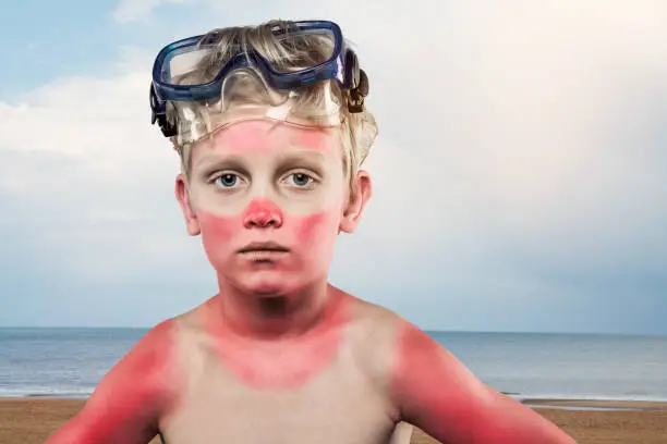 Sunburned boy wearing scuba mask standing in front of the sea
