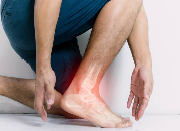 inflamación del tobillo óseo de los seres humanos con inflamación - pies fotografías e imágenes de stock