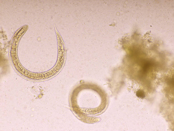 istock Strongyloides stercoralis or threadworm in human stool 1186707047