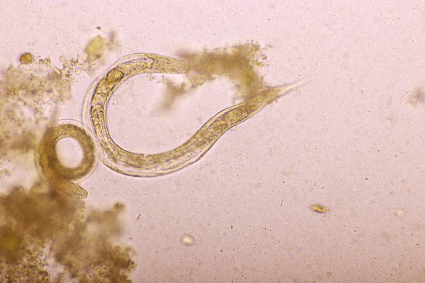 istock Strongyloides stercoralis or threadworm in human stool 1186707056