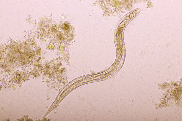 istock Strongyloides stercoralis or threadworm in human stool 1186707060