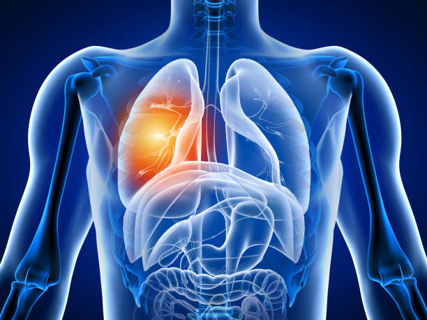 istock 3d illustration human body with lung pain 1186750536