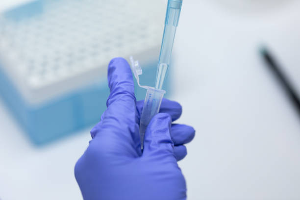 polymerase chain reaction (pcr) und agarose gel elektrophorese ist eine methode der gelelektrophorese in der biochemie, molekularbiologie, genetik und klinischen chemie im labor verwendet. - agarose stock-fotos und bilder