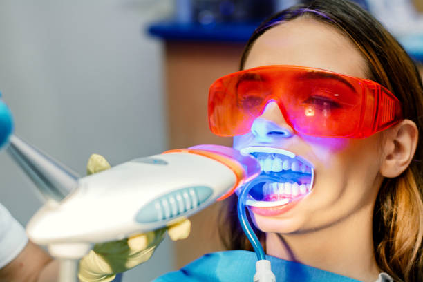 nahaufnahme des ultravioletten lichtverfahrens in der zahnarztpraxis. - dentists chair dental equipment dentist office dental drill stock-fotos und bilder