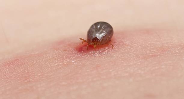 150+ Fotos, Bilder und lizenzfreie Bilder zu Rickettsiose Fotos iStock