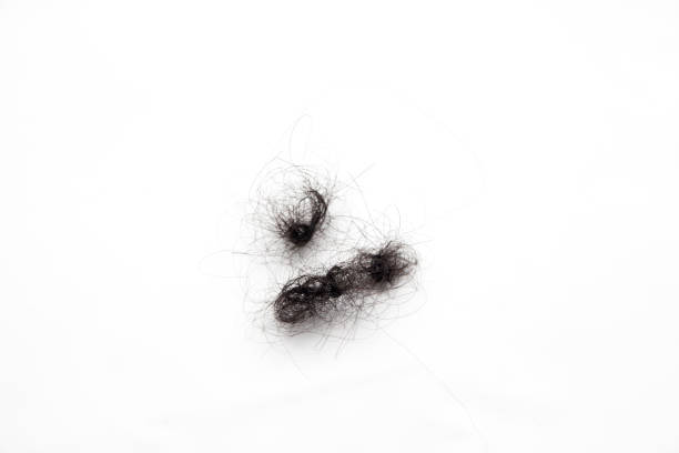 istock Fallen hair with isolated white background 1187400766