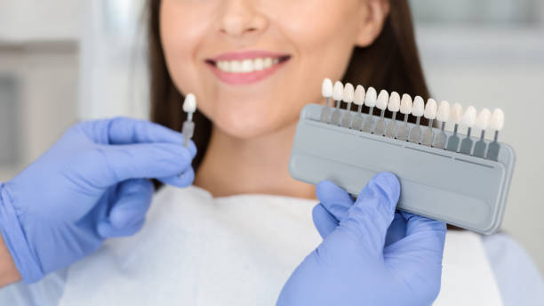 istock Doctor applying sample from tooth scale to smiling patient teeth 1187570282