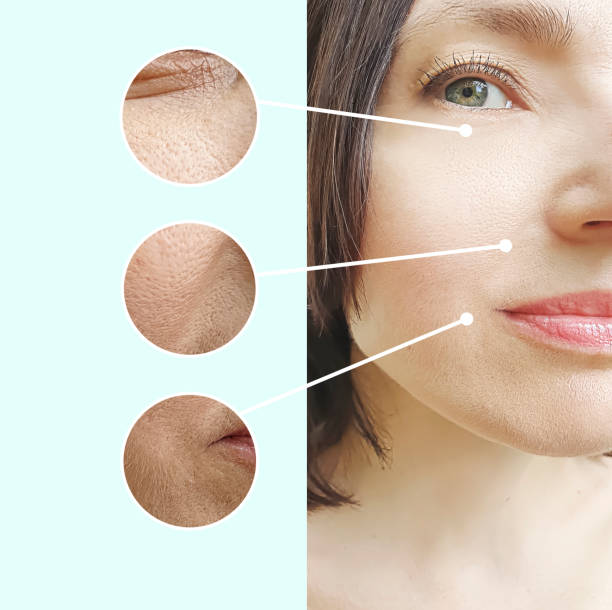 istock woman face wrinkles before and after treatment 1187647110