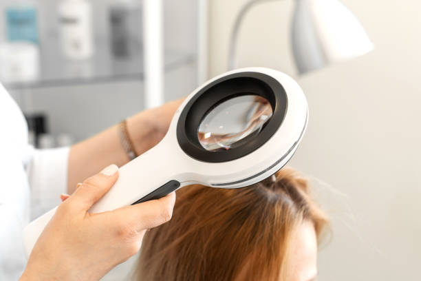 trycholog bada stan włosów na głowie pacjentów za pomocą dermatoskopu. w jasnej sali kosmetologii - nits zdjęcia i obrazy z banku zdjęć